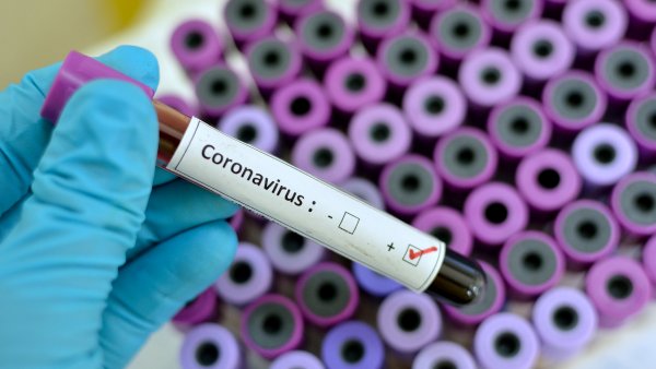 PHB Coronavirus (Test)
